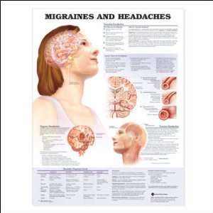 Migraines and Headaches Anatomical Chart 20 X 26  