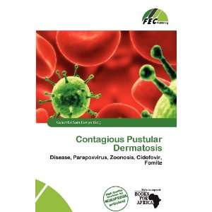  Contagious Pustular Dermatosis (9786200723116) Columba 