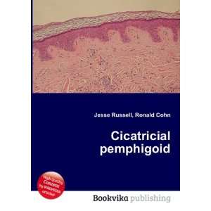  Cicatricial pemphigoid Ronald Cohn Jesse Russell Books