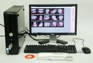 3M CCD WIRELESS Dental Intraoral Camera Ship From USA   