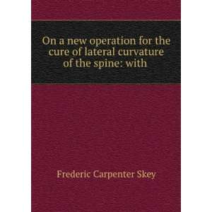   lateral curvature of the spine with . Frederic Carpenter Skey Books