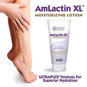   Moisturizing Lotion UltraplexTM Formulation 160 Grams 