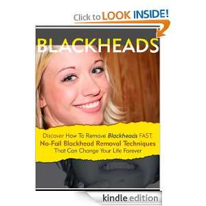 Blackheads How To Remove Blackheads Fast, No Fail Blackhead Removal 